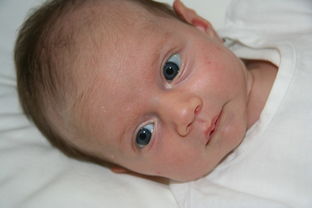 孕期妊娠合并新生儿两性畸形怎么染色体鉴定激素手术？
